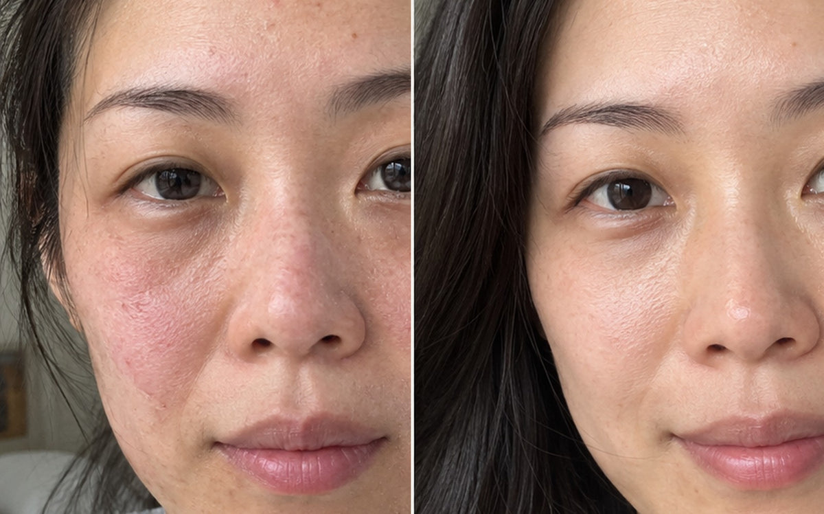 Facial before and after